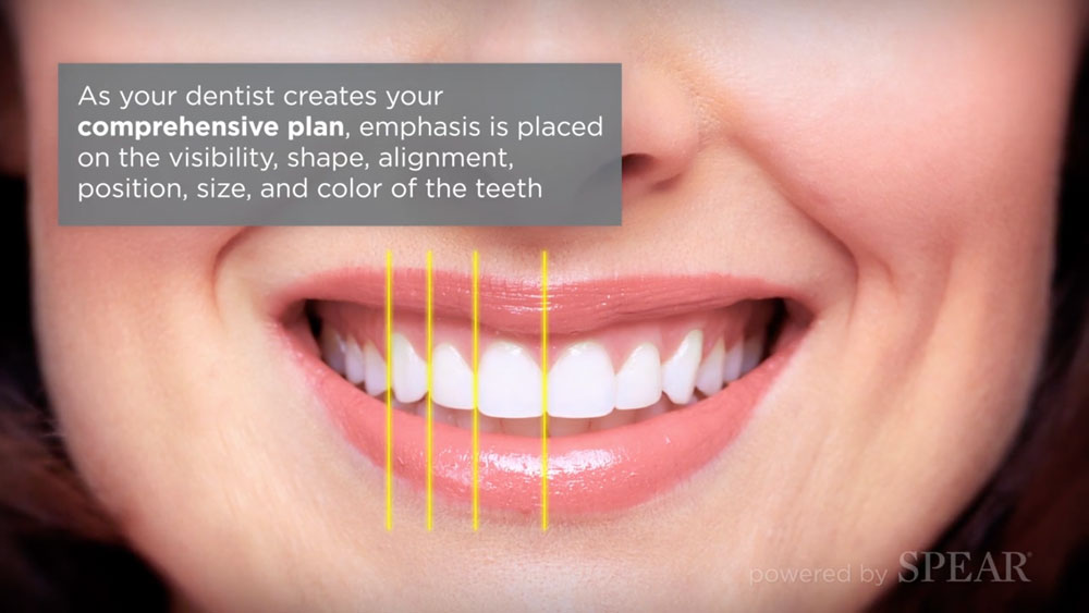 smile makeover
